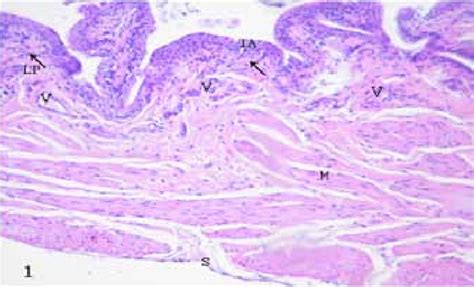 The Urinary Bladder Lined By Transitional Epithelium Ta Resting On