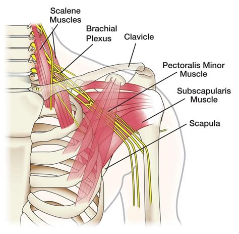 Best Physiotherapy Treatment For Brachial Plexus In Gurgaon