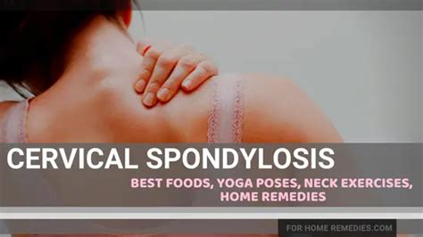 12 Effective Yoga Exercises Foods To Heal Cervical Spondylosis