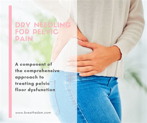 Dry Needling For Pelvic Floor Pain And Dysfunction
