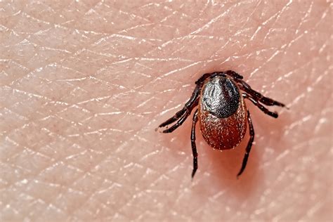 Lyme Disease In Asia Understanding The Threat