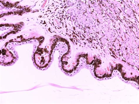 Anatomy Of Ciliary Body Ciliary Processes Anterior Chamber Angle And