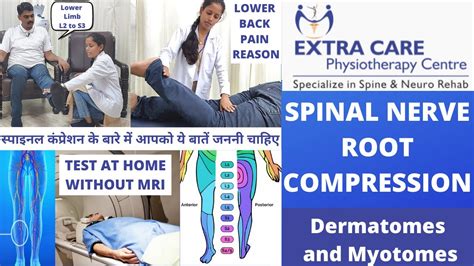 Nerve Root Compression Test For Lower Back Without Mri नर्व रूट का