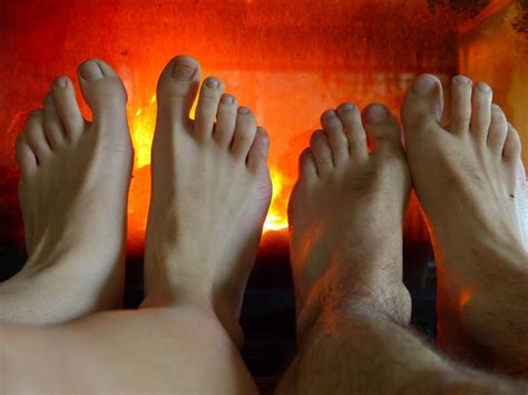 Hot Or Burning Feet Is A Common Complaint That Is Usually A Symptom Of