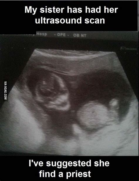 Creepy Ultrasound Pictures Thatll Make You Never Want Kids Really