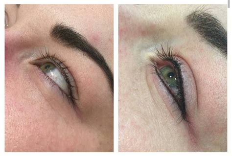 Before And After Photos Of Permanent Eyeliner In Las Vegas