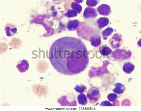 Mesothelial Cell Stock Photo Edit Now 738505516