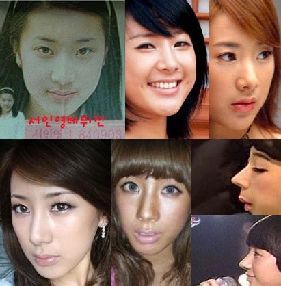 Hong jin young appeared on the latest episode of my there are cases when, hong jin young before plastic after, a person begins to have diseases that can end with amputation. Korean actresses before and after plastic surgery - All ...