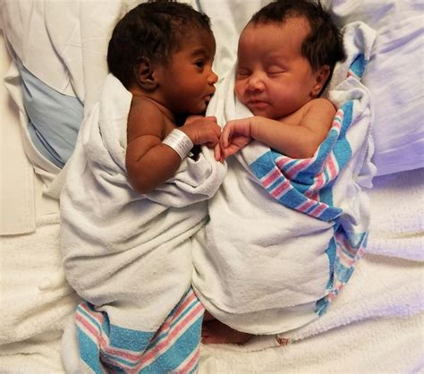 Twins Born With Different Color Skintones Win Over Our Hearts Proving