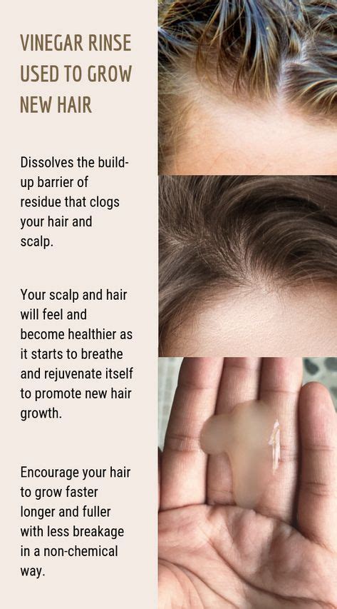54 Cool Pimples On Scalp After Haircut Haircut Trends