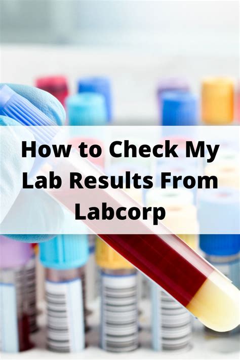 How To Check My Lab Results From Labcorp Healthcare Industry Health