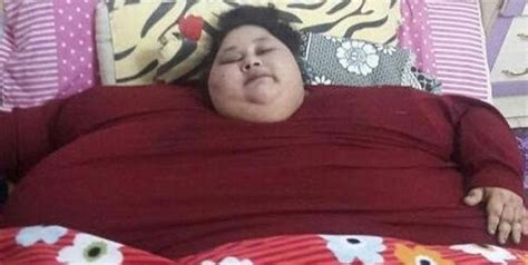 El nuevo récord de la mujer más gorda del mundo pierde kilos tras operación en India