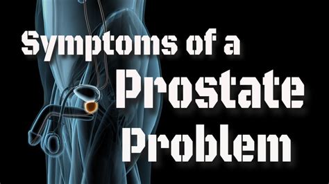 Symptoms Of Prostate Problem Youtube