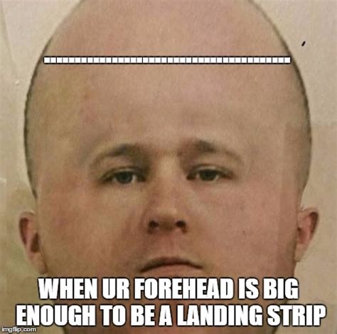 Big Forehead Meme Kampion