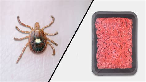 How A Tick Bite Can Make You Allergic To Meat