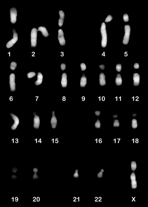 Q Banded Karyotype Of A Normal 23x Sperm Download Scientific Diagram