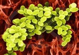 Bakteri Staphylococcus Aureus Klasifikasi Sifat Gram Morfologi Health