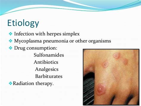 Vesicular And Bullous Lesions Power Point