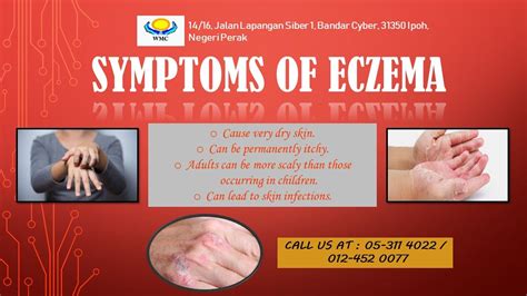 Symptoms Of Eczema Eczema Symptoms Eczema Causes Eczema Treatment