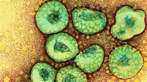 Sars Like Virus Death Reported In Uk Bbc News