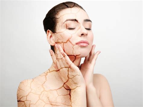 How To Care For Dry Skin Types Of Dry Skin