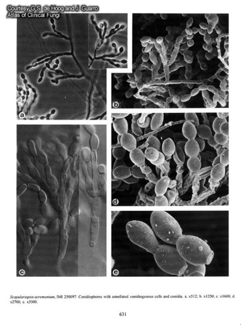 Sacremonium1 Doctor Fungus