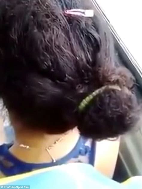 Womans Head Filmed Crawling With Bugs In Mexico Daily