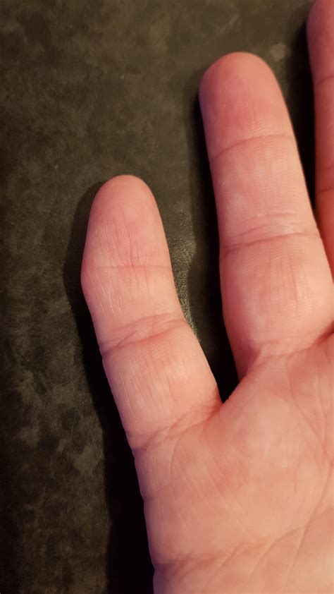 My Pinky Finger Has An Extra Bone In It The Little Nub Even Has Its Own Fingerprint R