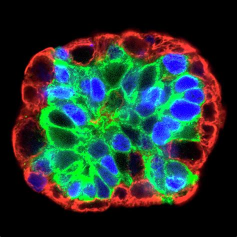 Breast Cancer Stem Cell Culture Photograph By Salk Institutenational