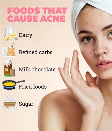 Diet For Acne Prone Skin