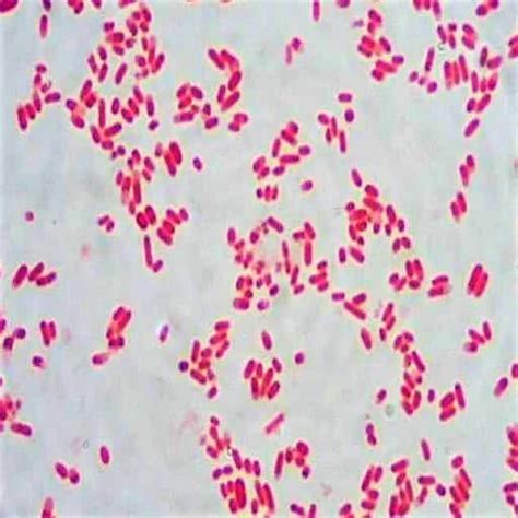 Escherichia Coli Gram Stain Escherichia Coli And Bacillus Sp