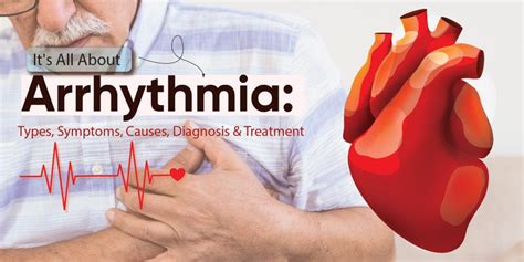 Arrhythmia Symptoms Causes Types Diagnosis And Treatment