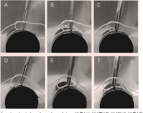 Figure From In Vitro Biomechanical Comparison Of Clamped Suture Knot