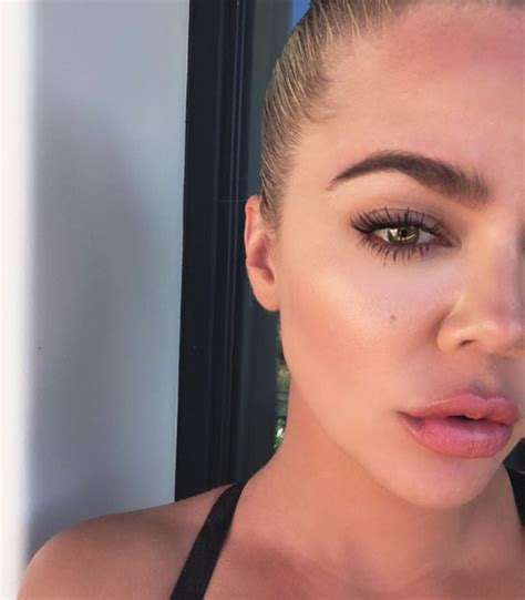 Khloé Kardashian Silences Critics After Accusations Of Lip Injections