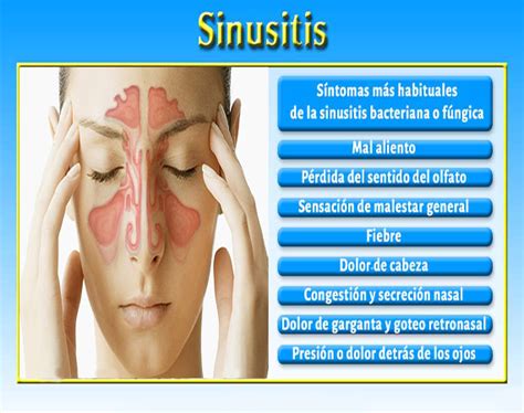 Sinusitis Causas Síntomas Y Cómo Tratarla De Forma Natural