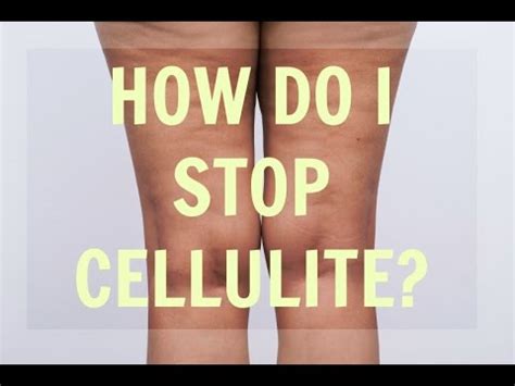 Why Do Women Get Cellulite And How Do I Prevent Cellulite Youtube