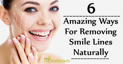 6 Amazing Ways For Removing Smile Lines Naturally Find Home Remedy And Supplements