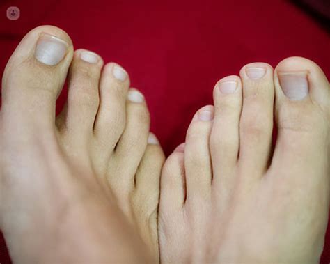10 Common Foot Problems And How To Manage Them Everyday Health Vn