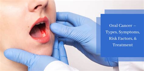 Oral Cancer Types Symptoms Risk Factors And Treatment