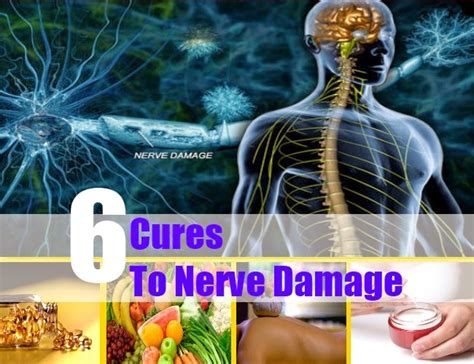 6 Cures To Nerve Damage ~ Mzizi Mkavu
