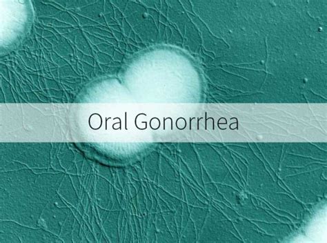 Oral Gonorrhea Std