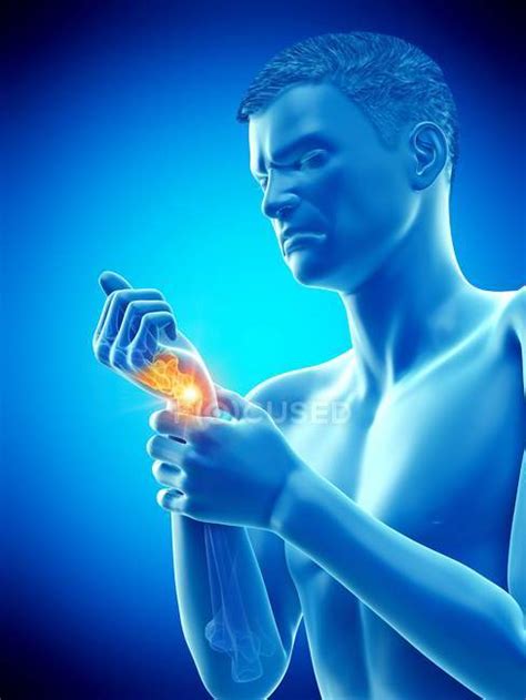 Abstract Man Body With Wrist Pain Conceptual Illustration — Wrist