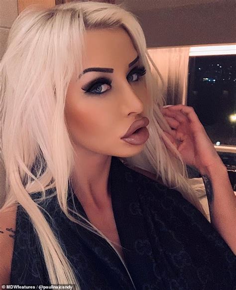 Model Reveals How She Spent On Surgery To Look Like Barbie