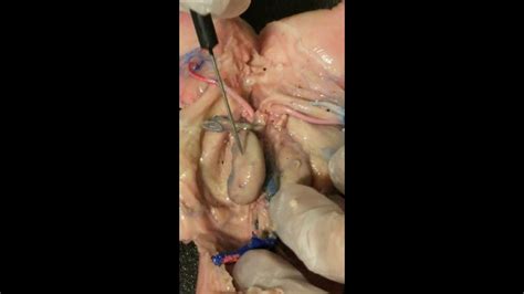 Lapu Fetal Pig Urinary System Youtube