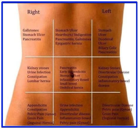 Typical And Atypical Ibs Pain Locations A Complete In Depth Guide