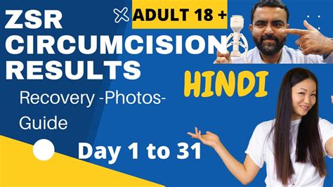 Zsr Circumcision Recovery Healing Phases For Patients Info With Photos Hindi Drkuber
