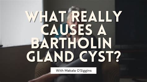 Bartholin Cysts Root Causes Youtube