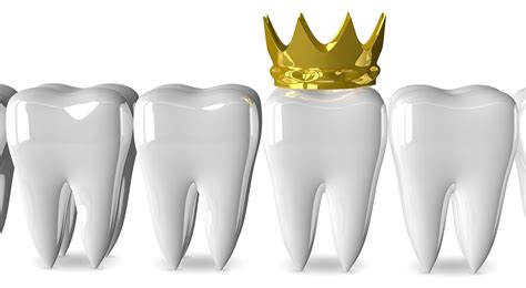 As far as needs go, it is the main factor for determining what material will be used to fabricate the crown. Which dental crown should I choose? | Core | Article