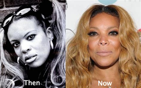 Wendy Williams Plastic Surgery Before And After Photos