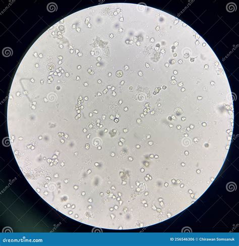 Moderate Bacteria And White Blood Cells In Urine Stock Photo Image Of